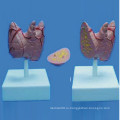 Демонстрационная модель медицинской анатомии человека щитовидной железы (R130105)